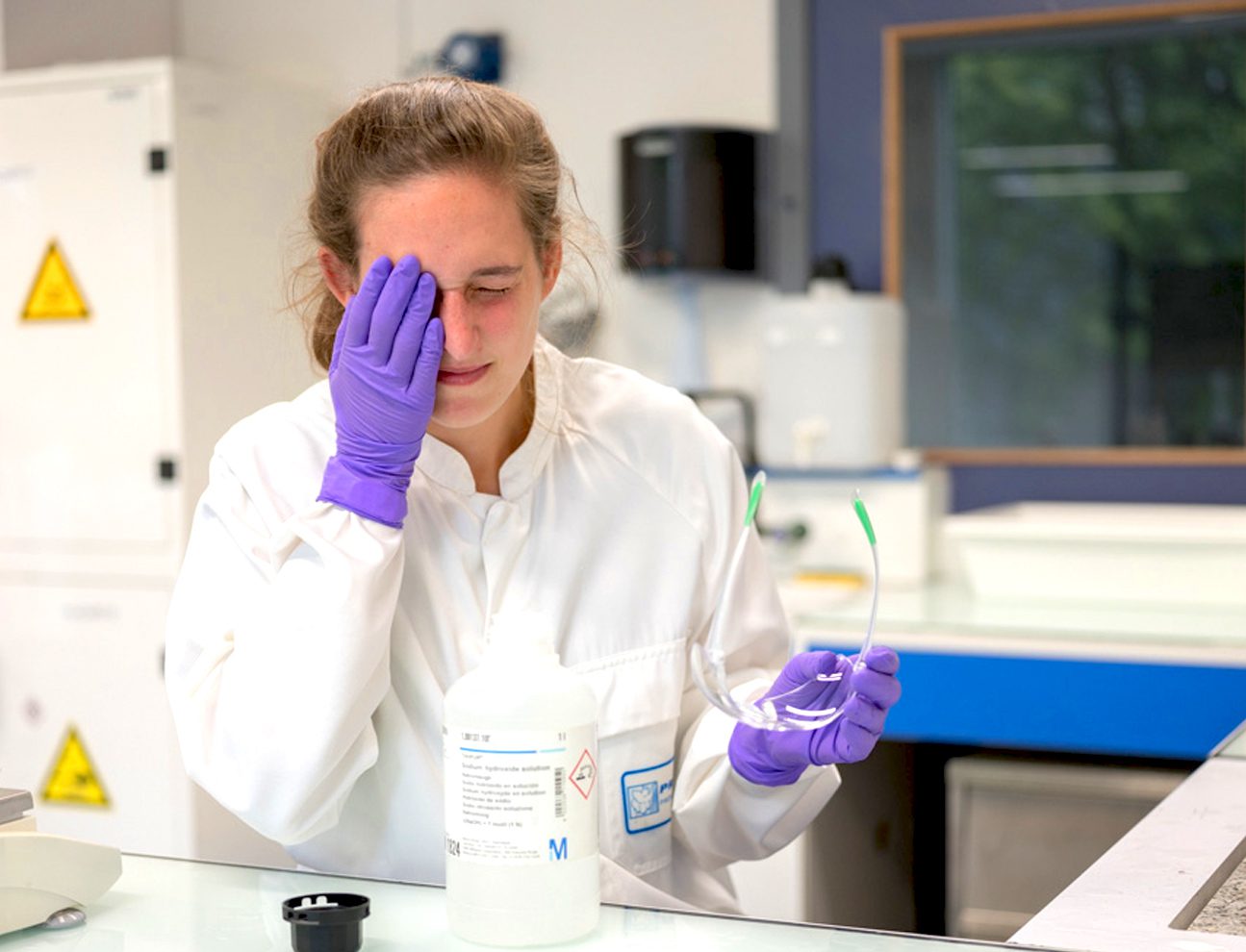 Técnica de laboratório após receber uma projeção química no rosto